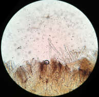 Image of Rutstroemia sydowiana (Rehm) W. L. White 1941