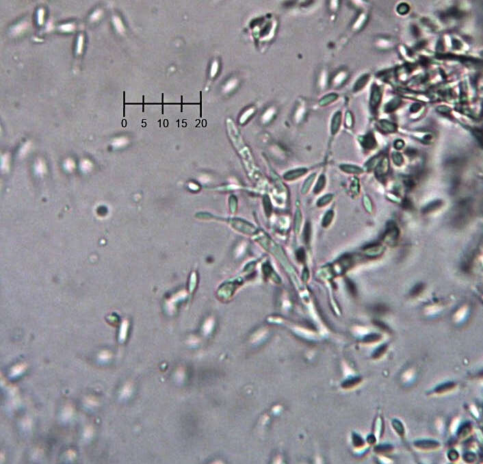 Image of Eleutheromyces subulatus (Tode) Fuckel 1870