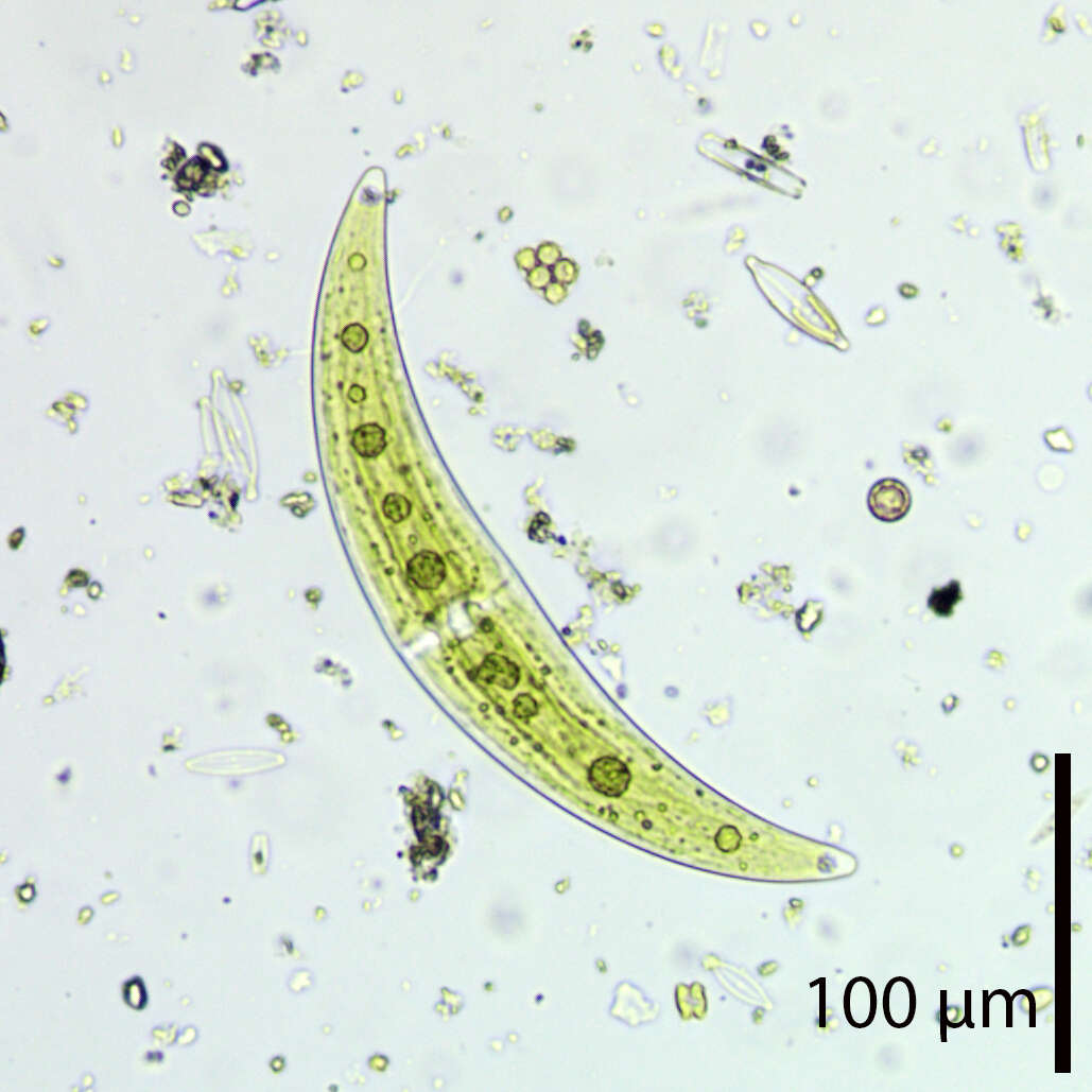 Image of Closterium moniliferum