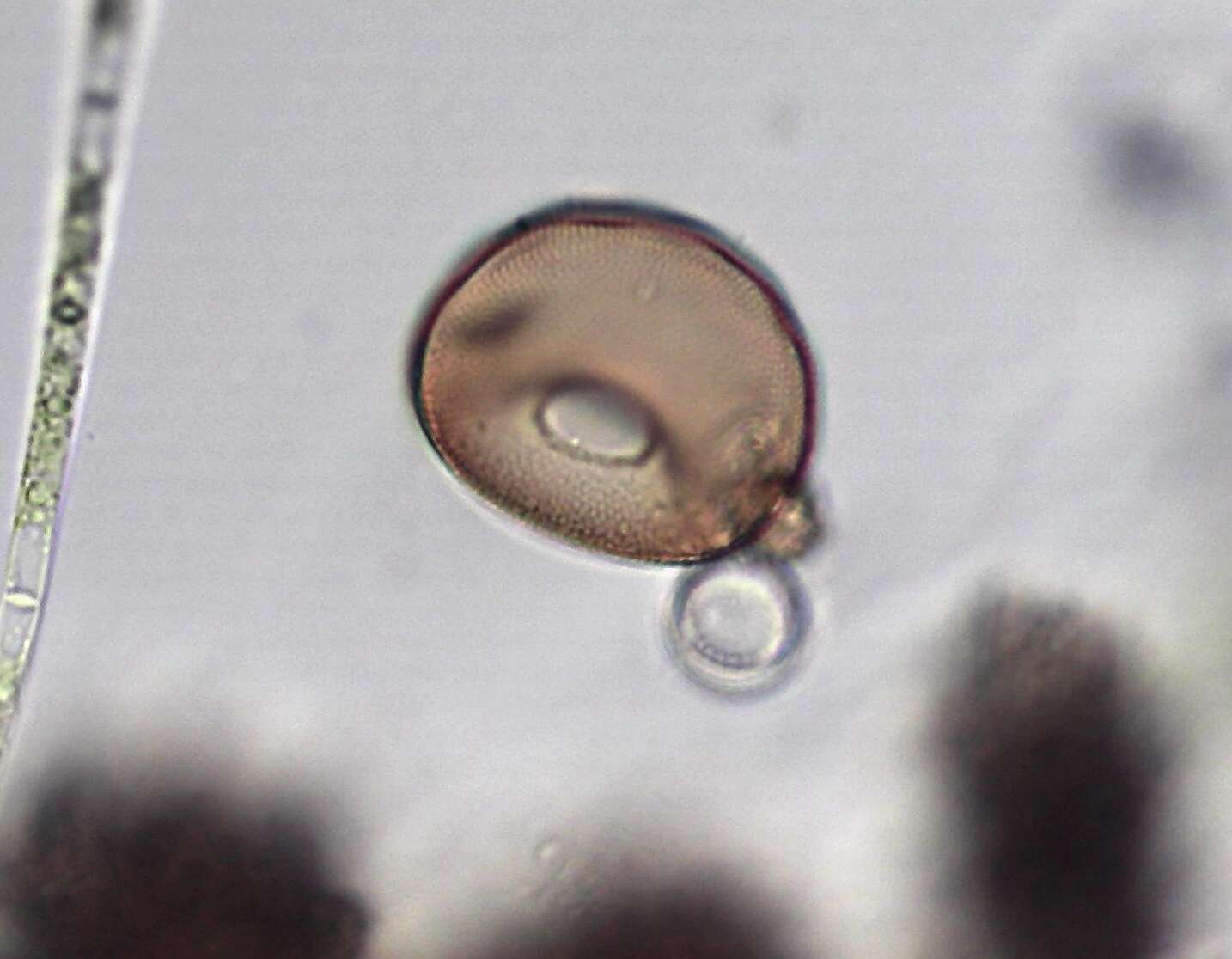 Image of Arcella hemisphaerica