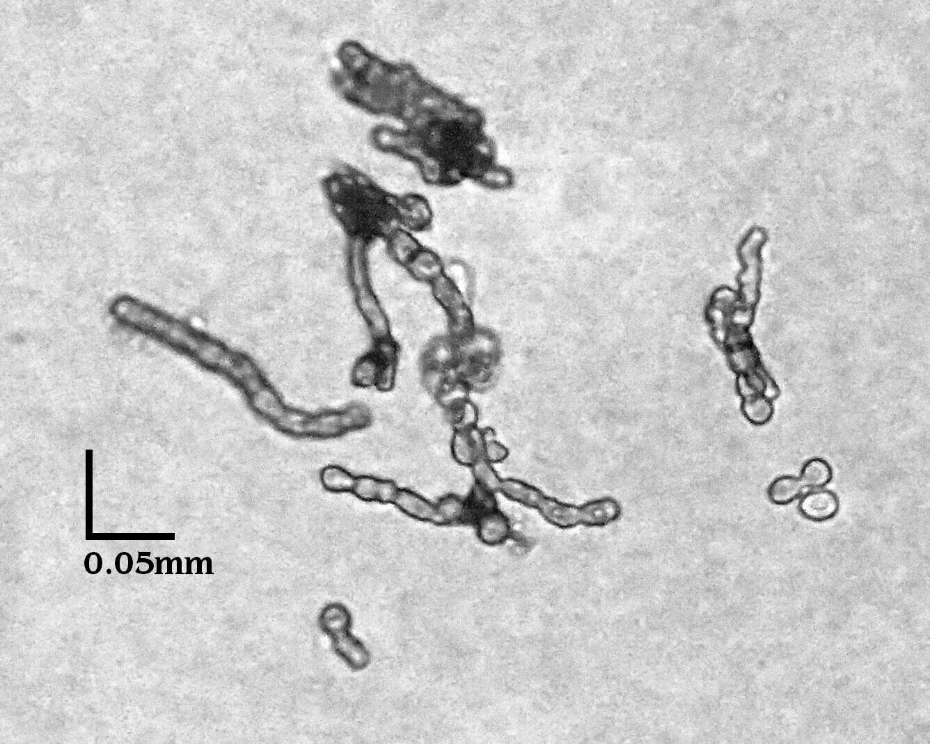 Image of Baudoinia compniacensis (Richon) J. A. Scott & Unter. 2007