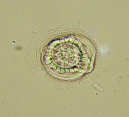 Sivun Trichodina pediculus kuva