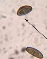 Hypomontagnella submonticulosa的圖片