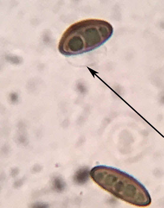 صورة Hypomontagnella submonticulosa