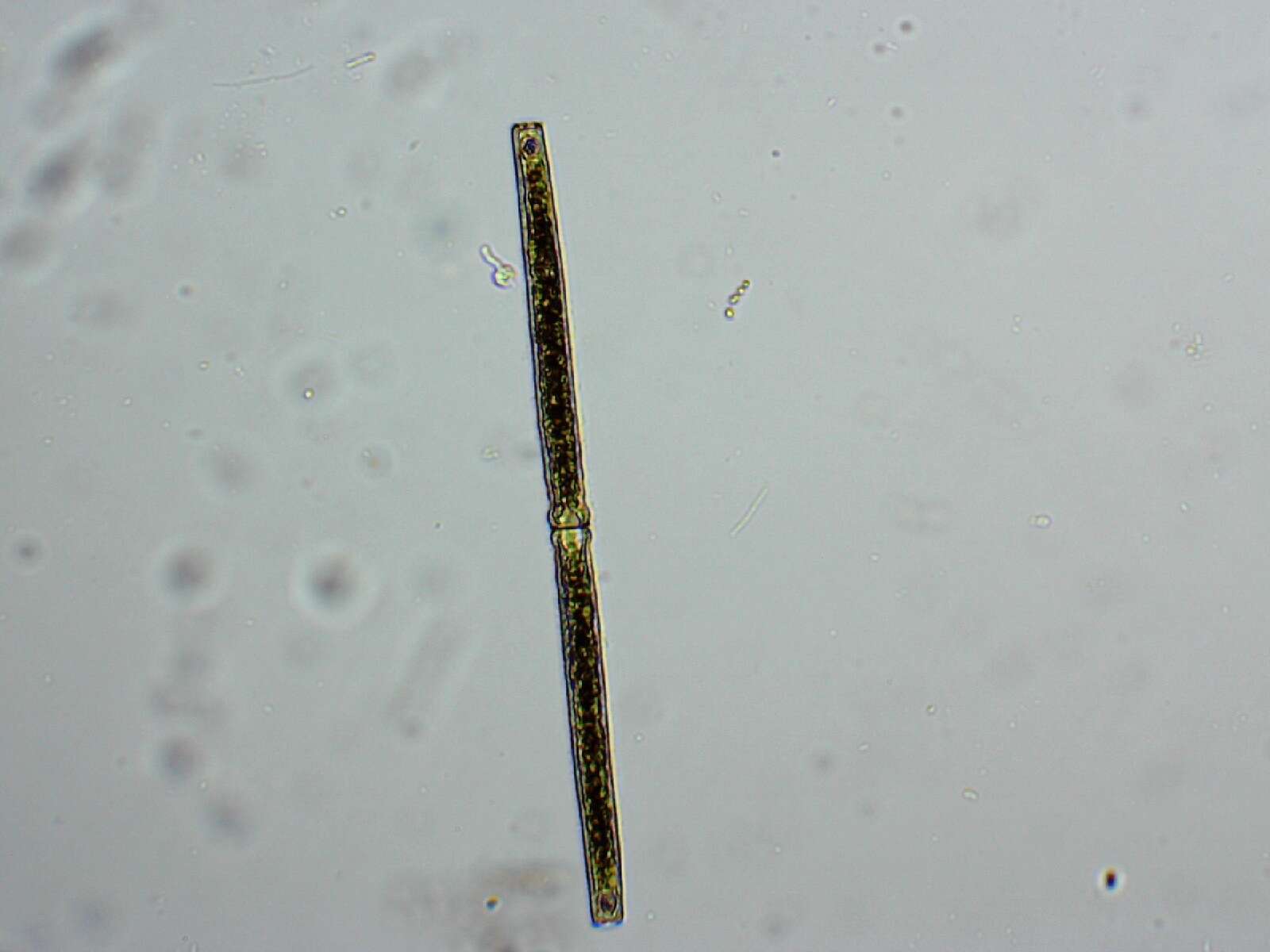 Image of Pleurotaenium ehrenbergii