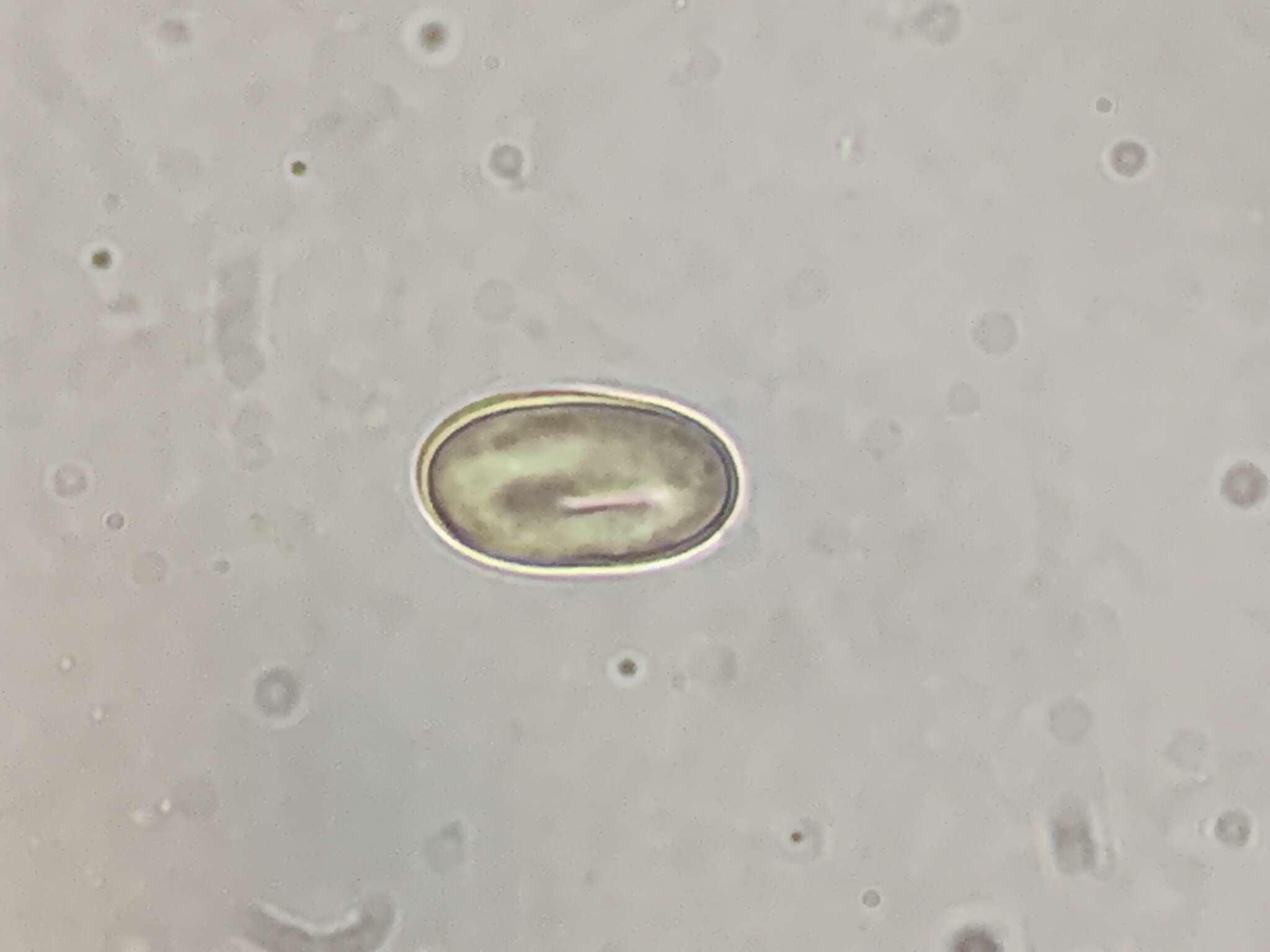 Image of Pseudombrophila cervaria (W. Phillips) Brumm. 1995