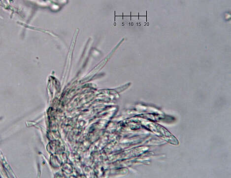 Plancia ëd Eupezizella aureliella (P. Karst.) T. Kosonen, Huhtinen & K. Hansen