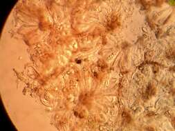 Image of steinia lichen