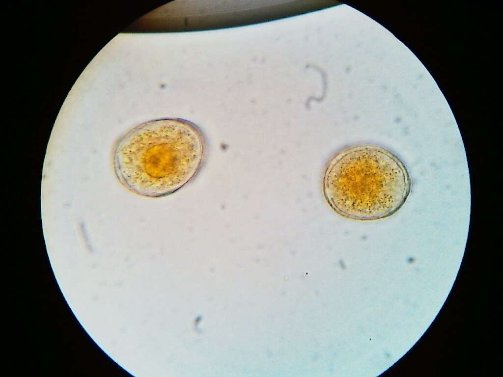 Imagem de Puccinia asparagi DC. 1805