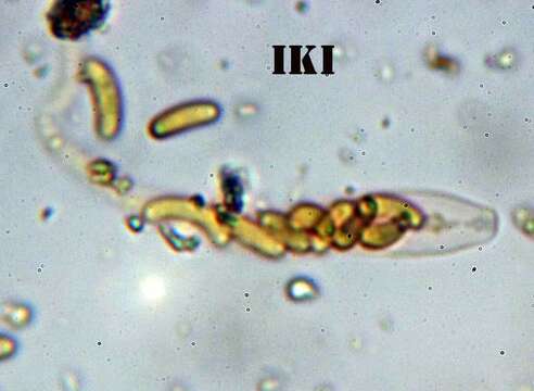 Eutypa flavovirens (Pers.) Tul. & C. Tul. 1863 resmi