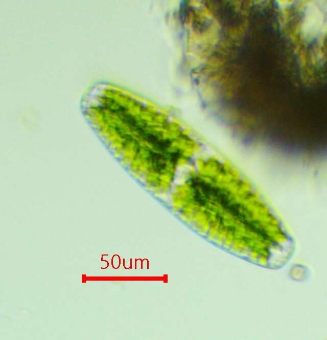 Netrium (Naegeli) Itzigsohn & Rothe 1856的圖片