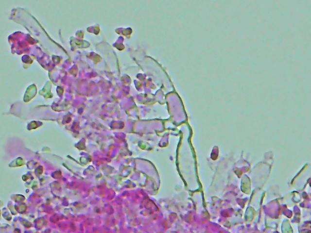 صورة Tylospora asterophora (Bonord.) Donk 1960