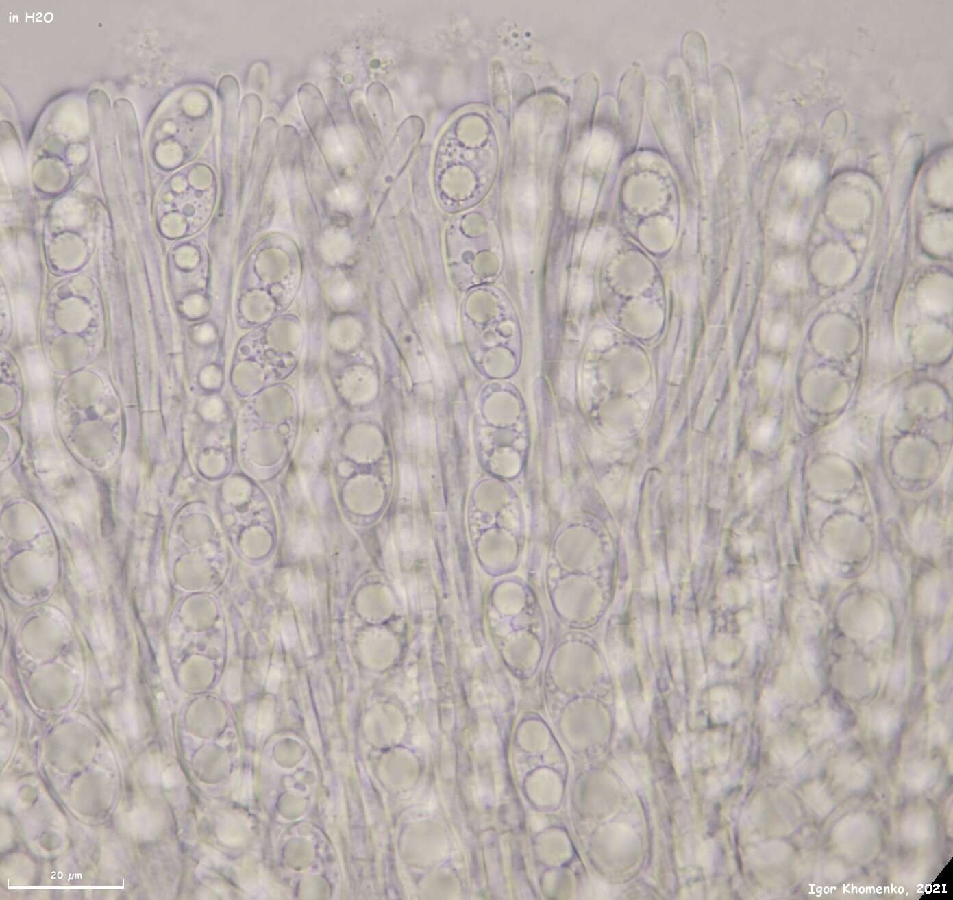 Image of Tarzetta catinus (Holmsk.) Korf & J. K. Rogers 1971