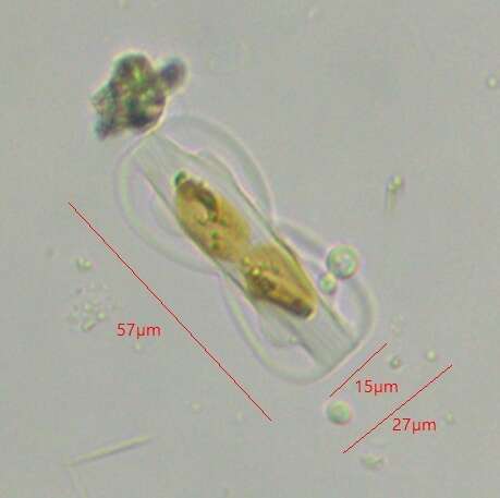 Plancia ëd Entomoneis paludosa