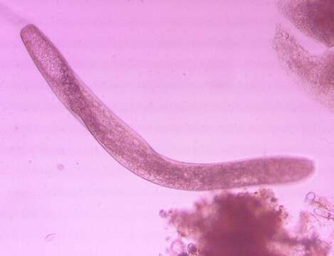 Слика од Spirostomum ambiguum