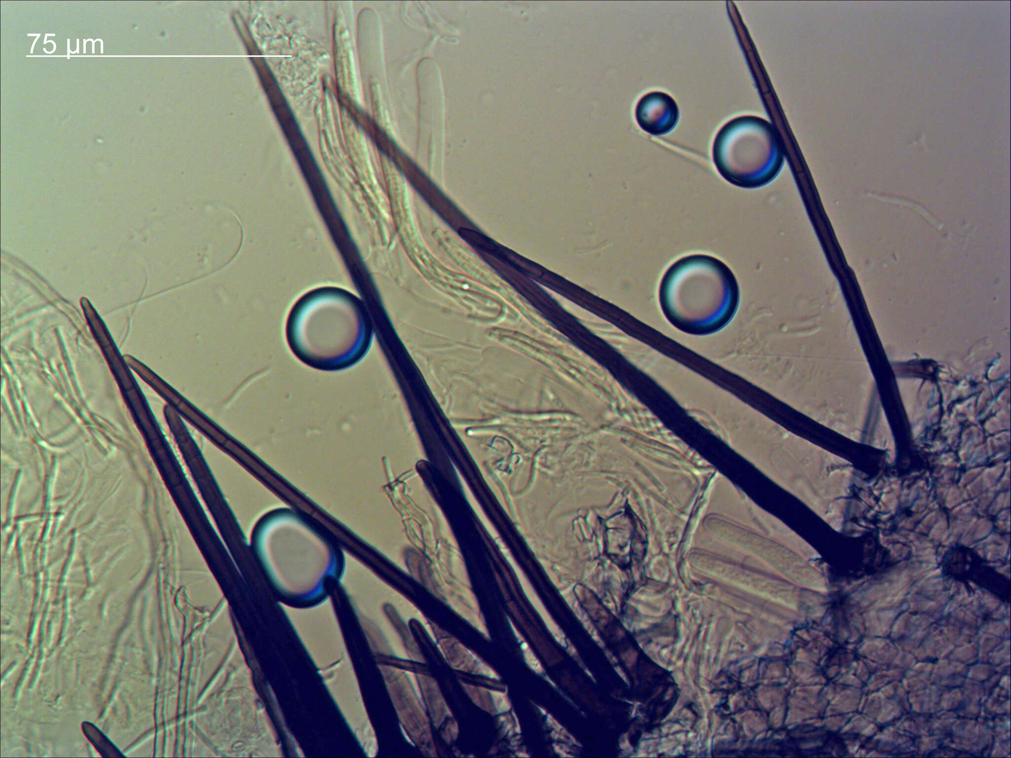 Image of Acanthophiobolus helicosporus (Berk. & Broome) J. Walker 1972