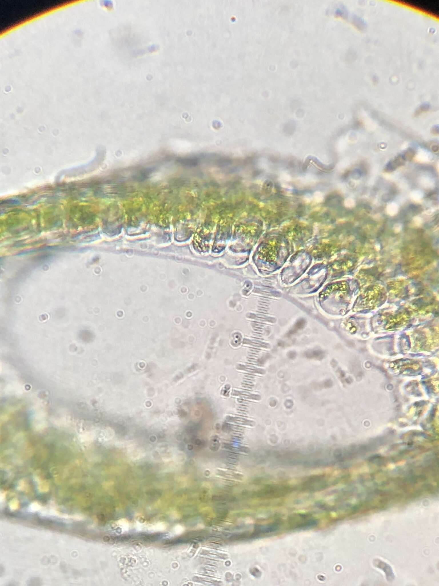 Image of Blidingia subsalsa (Kjellman) Kornmann & Sahling ex Scagel et al. 1989