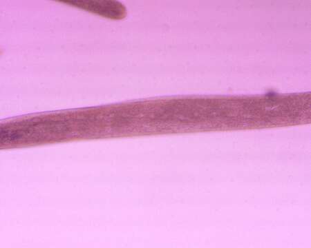 Слика од Spirostomum ambiguum