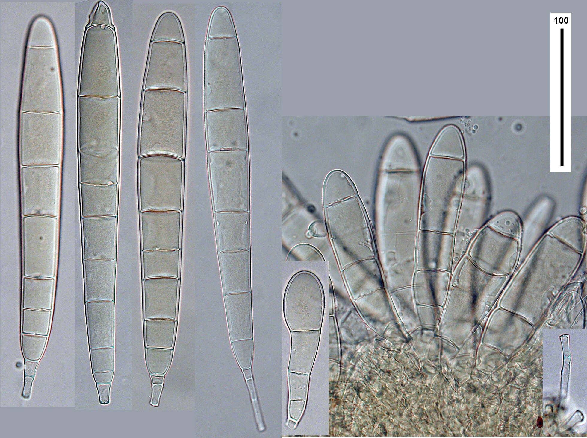 Image of Bactridium clavatum Berk. & Broome 1873