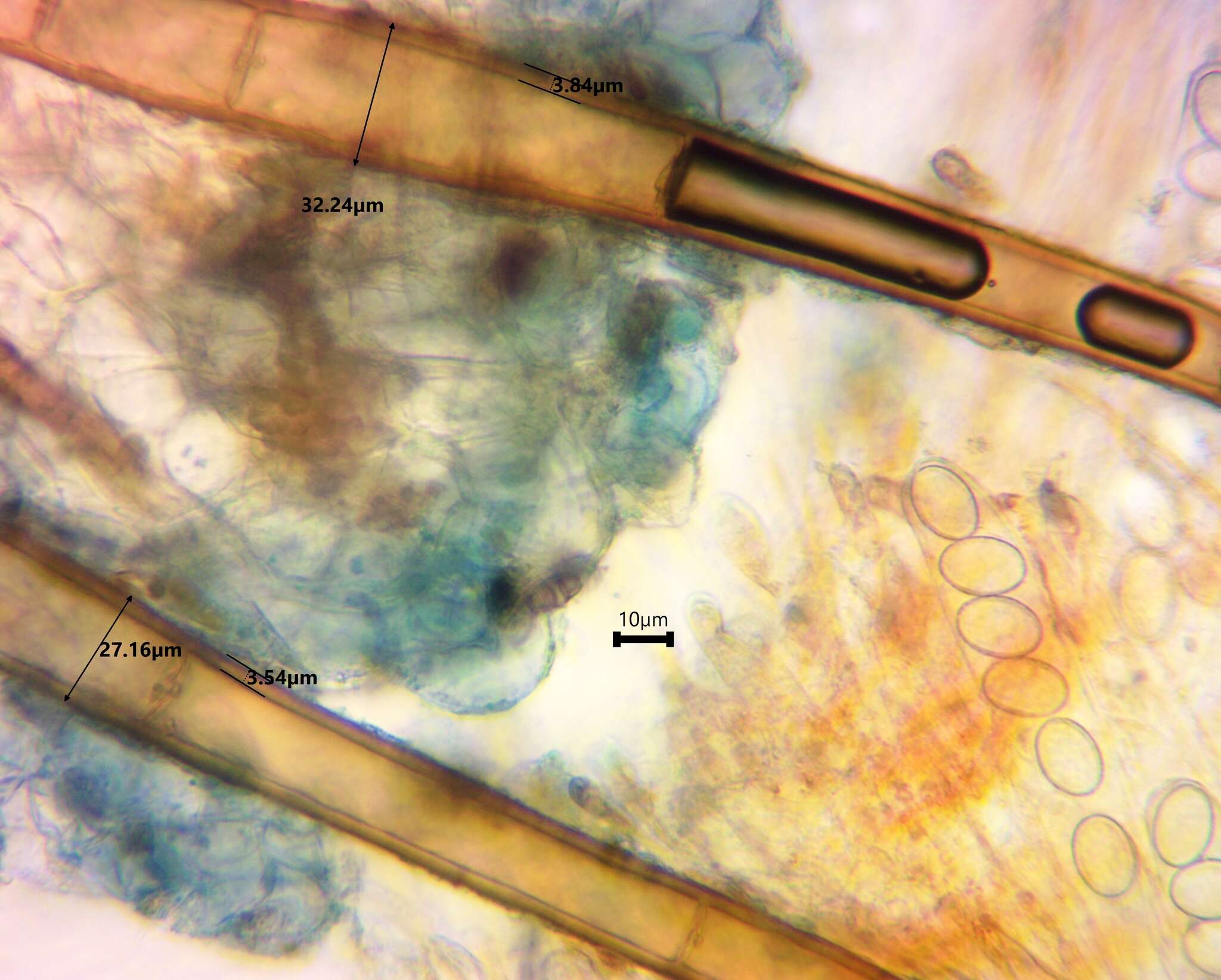 Image of Scutellinia vitreola Kullman 1982