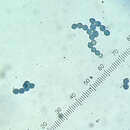 Microascus brevicaulis S. P. Abbott 1998 resmi