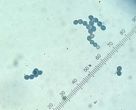 Image of Microascus brevicaulis S. P. Abbott 1998