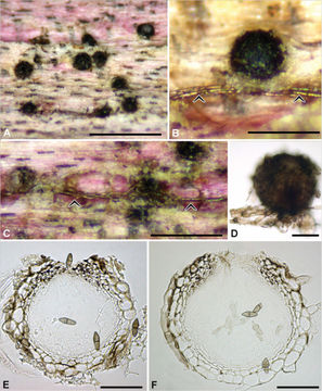 Image of Jahnula purpurea J. Fourn., Raja & Shearer 2015