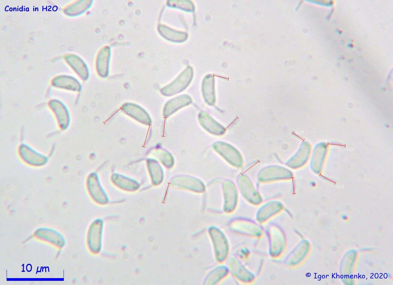 Слика од Dinemasporium decipiens (De Not.) Sacc. 1881