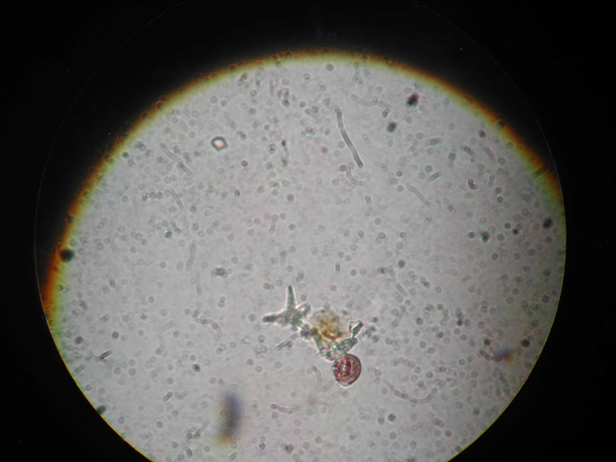 Image of Didymium anellus