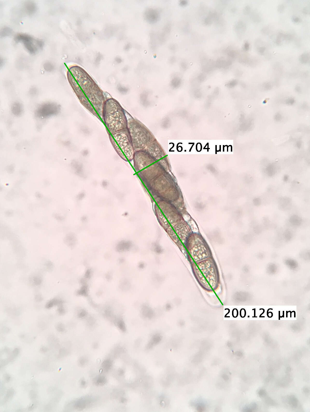 Image of Prosthecium appendiculatum (G. H. Otth) M. E. Barr 1978