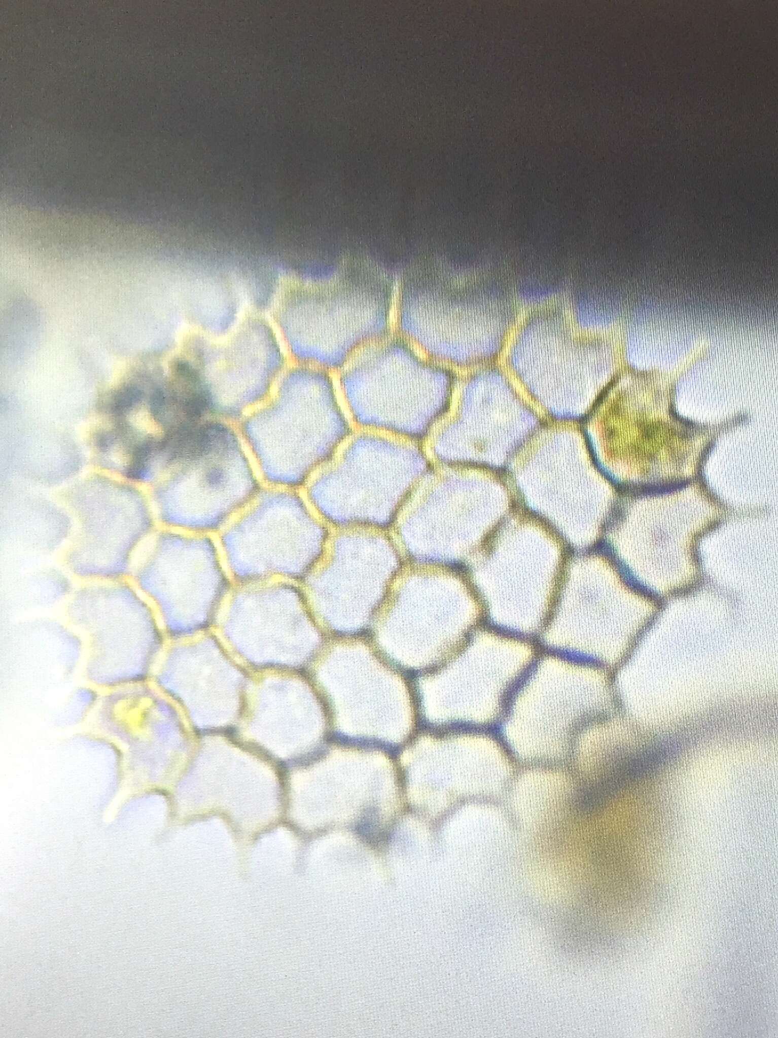 صورة Pseudopediastrum