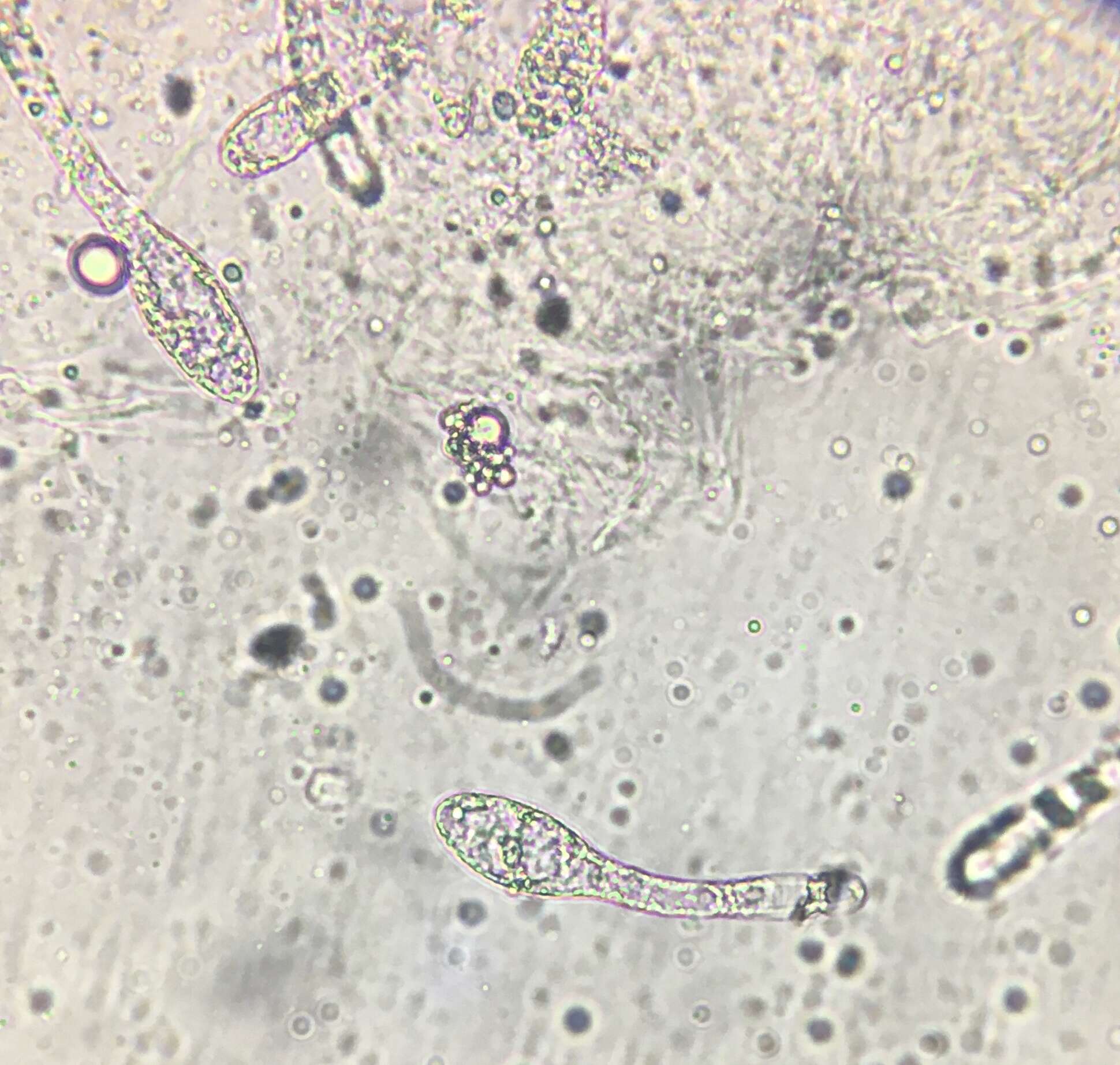 Podospora pleiospora (G. Winter) Niessl 1883的圖片