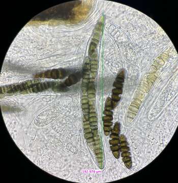 Image of Sporormiella octonalis S. I. Ahmed & Cain 1972