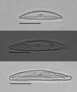 Image of <i>Encyonema evergladianum</i> Krammer 1997