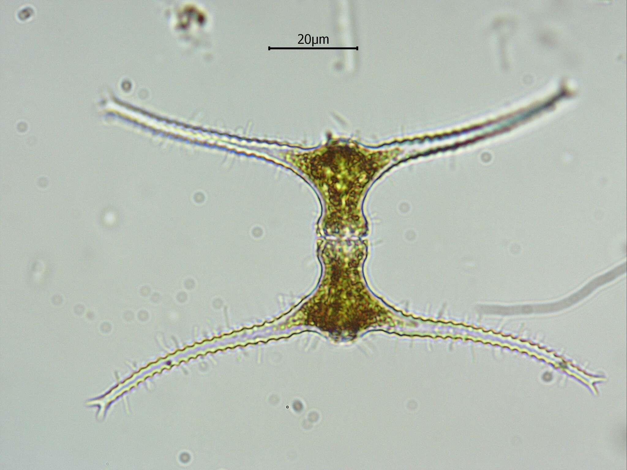 Image of Staurastrum leptocladum