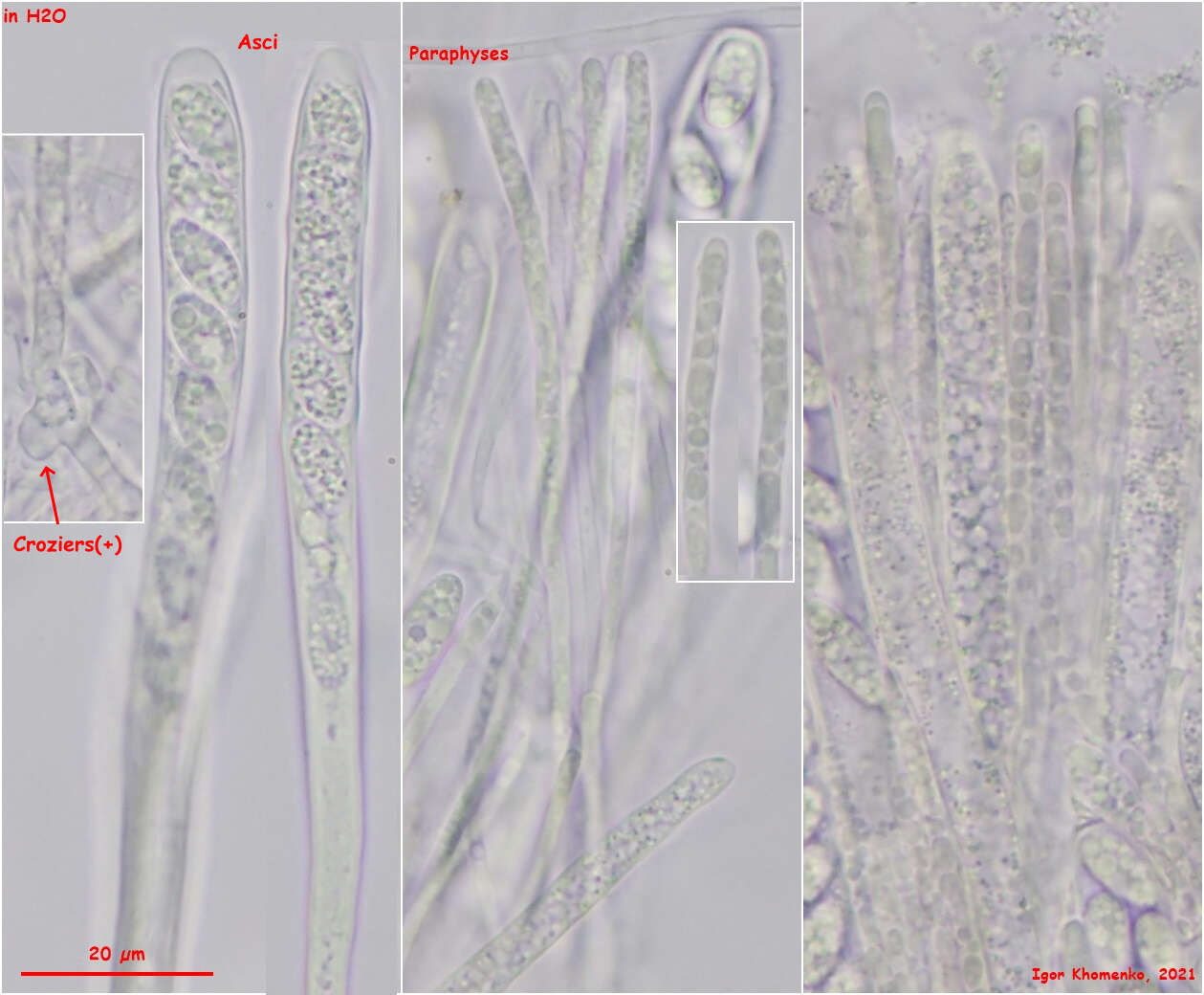 Plancia ëd Pyrenopeziza personata (P. Karst.) Boud. 1907