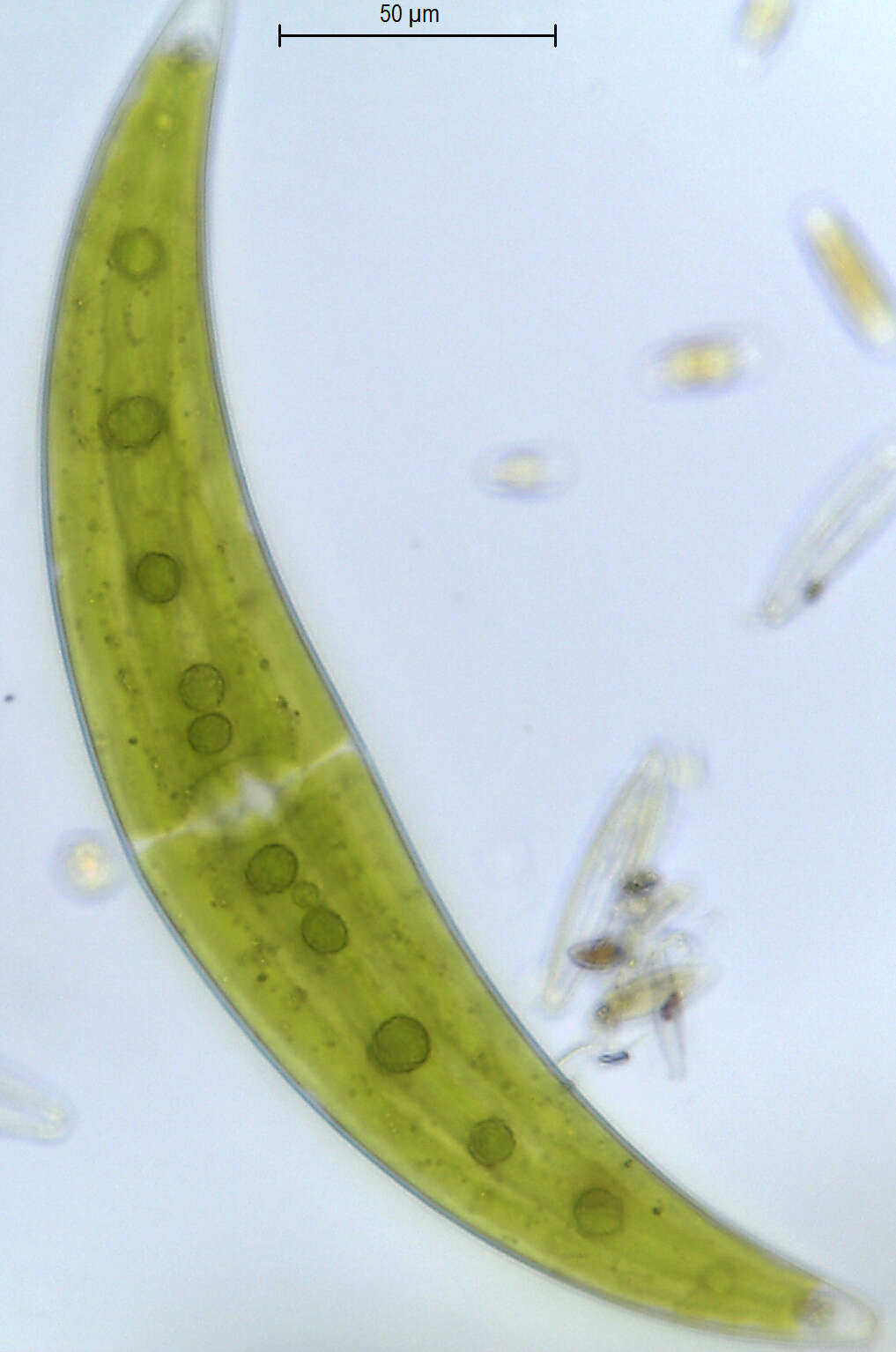 Image of Closterium moniliferum