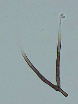 Image of Pseudallescheria boydii (Shear) McGinnis, A. A. Padhye & Ajello 1982