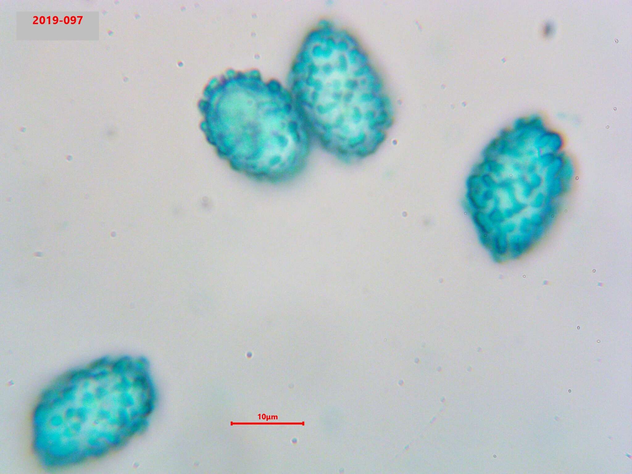 Scutellinia pennsylvanica (Seaver) Denison 1961 resmi