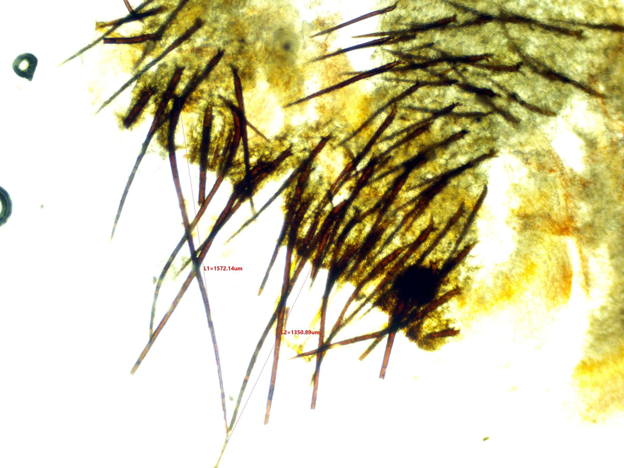Image of Scutellinia colensoi Massee ex Le Gal 1967