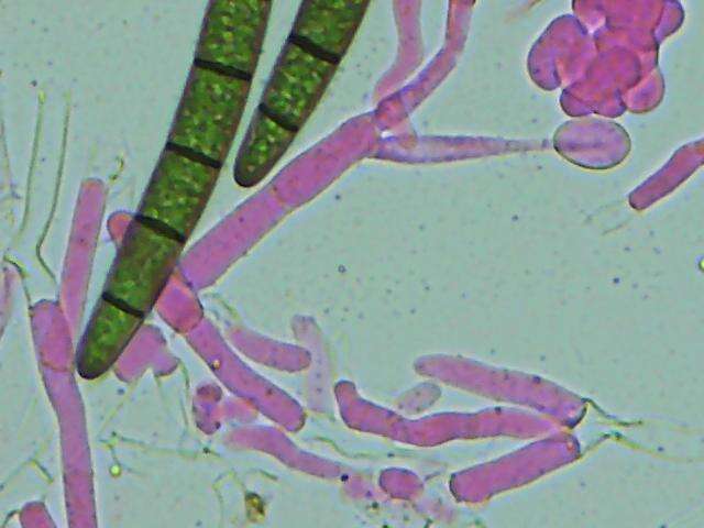 Слика од Hypomyces papulasporae Rogerson & Samuels 1985