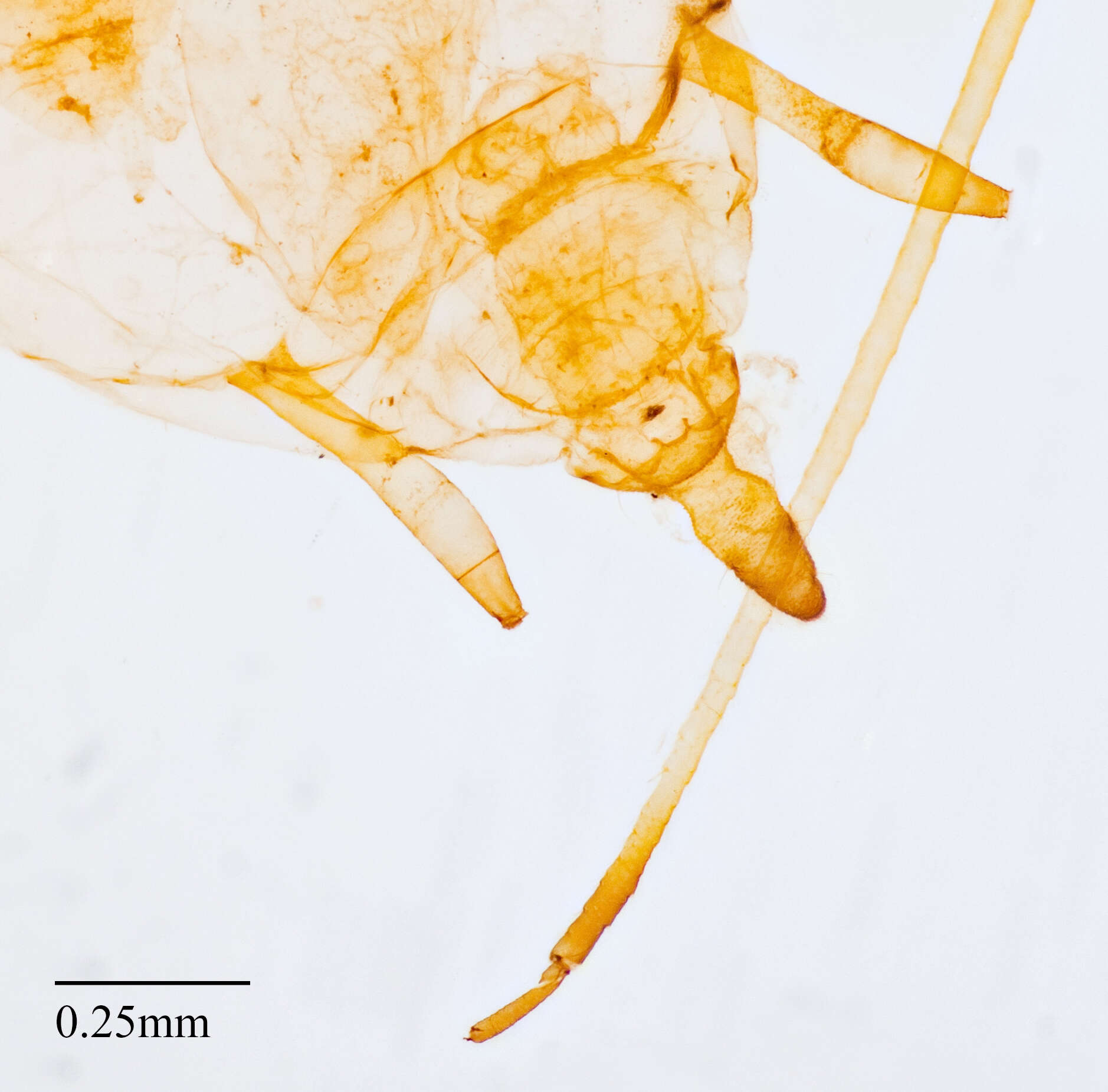 Image of Blackcurrant--Sowthistle Aphid