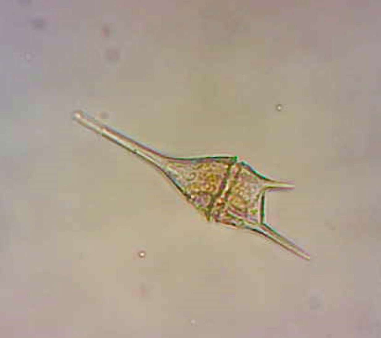 Image of Neoceratium lineatum