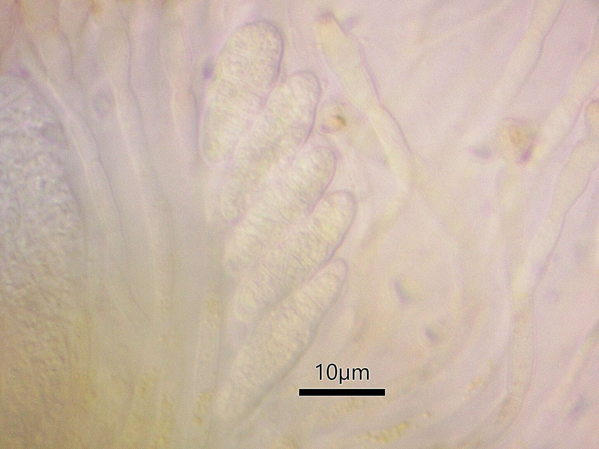 Sivun Gyalecta truncigena (Ach.) Hepp kuva