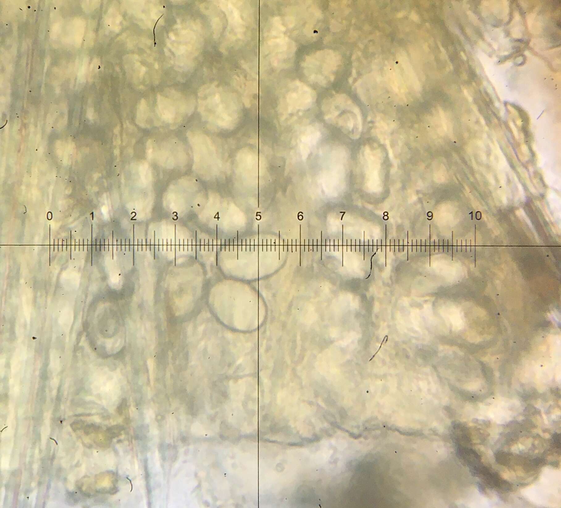 Image de Lasiobolus intermedius J. L. Bezerra & Kimbr. 1975