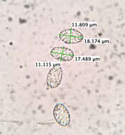 Image de Scutellinia vitreola Kullman 1982