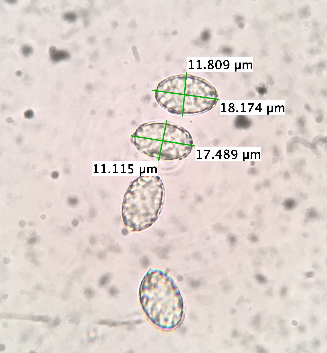 Image de Scutellinia vitreola Kullman 1982