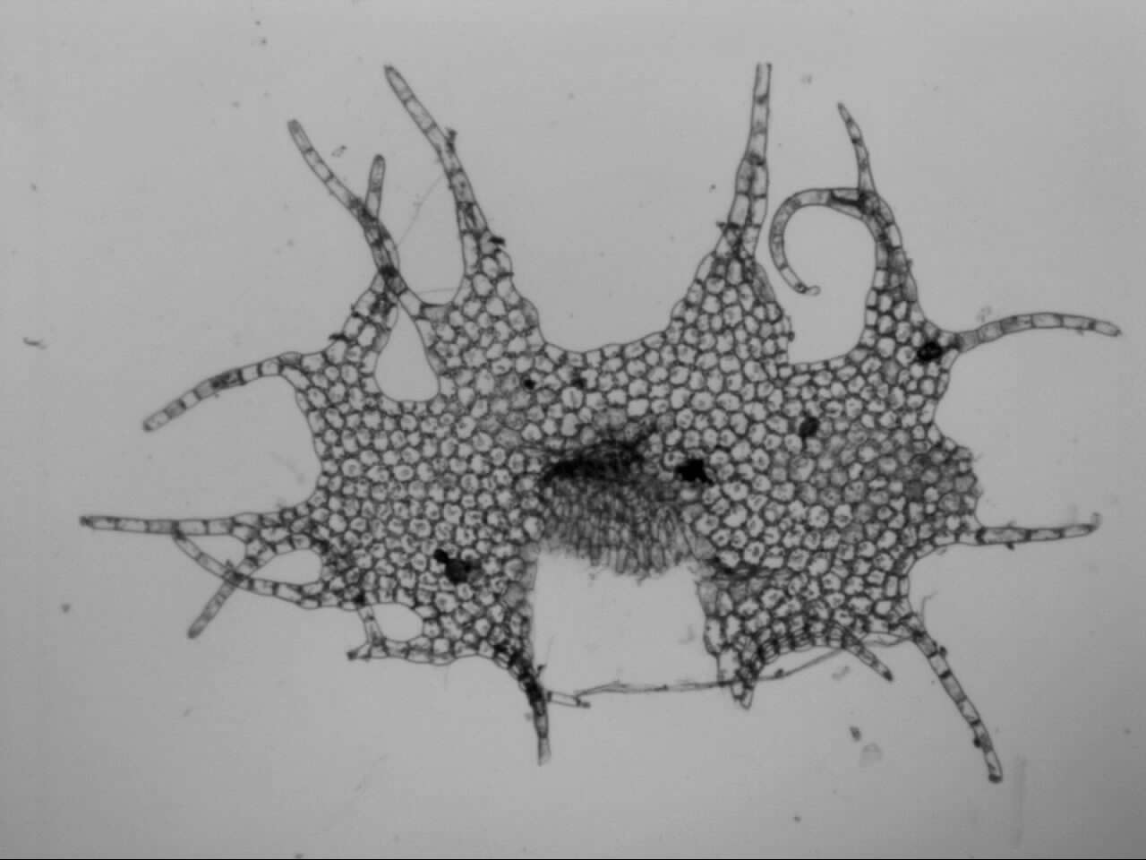 Sivun Heteroscyphus fissistipus (Hook. fil. & Taylor) Schiffn. kuva