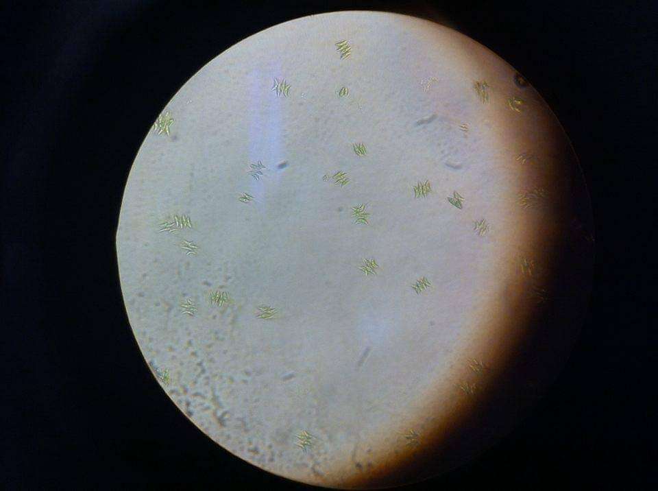 Tetradesmus dimorphus的圖片