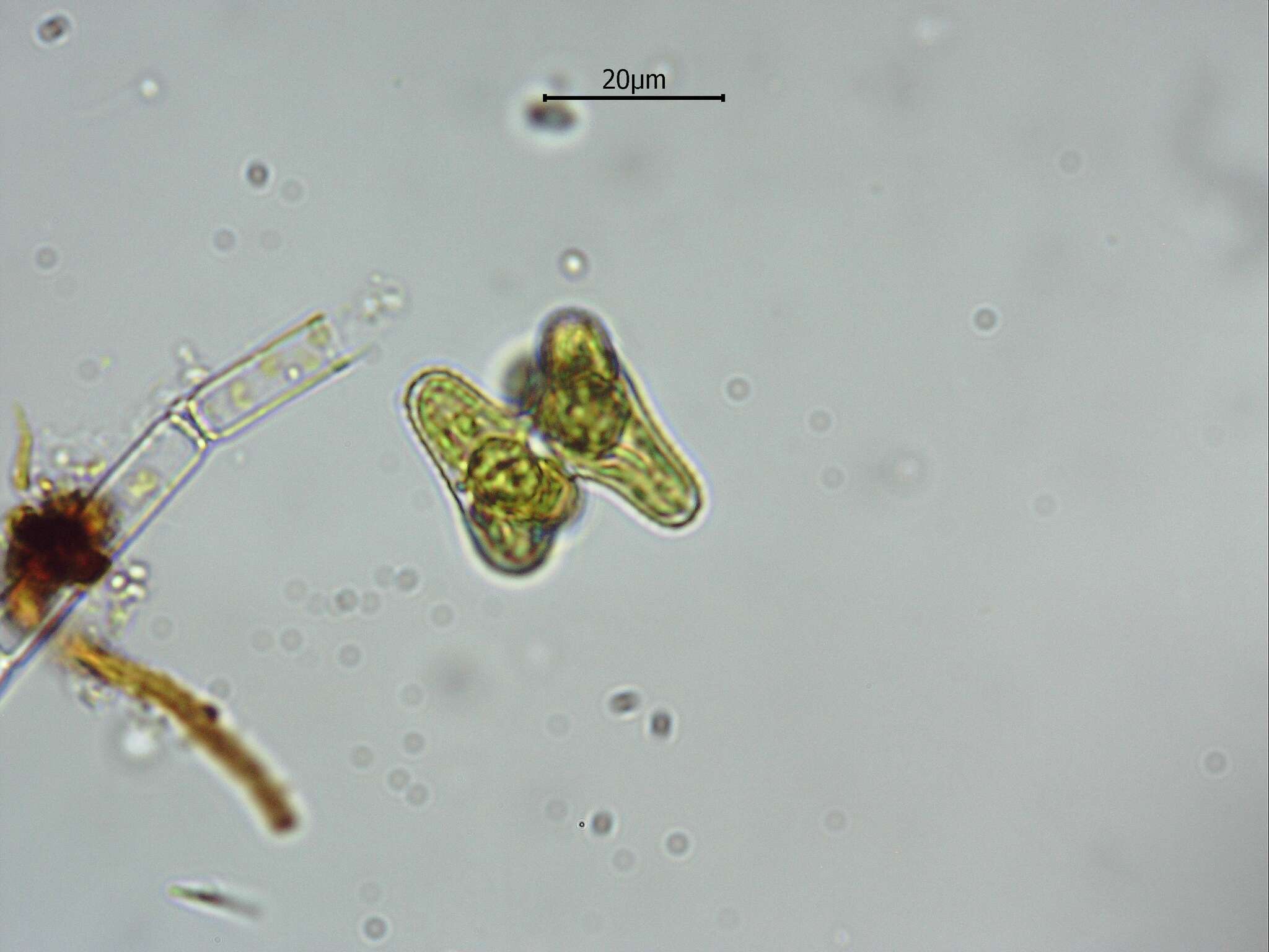 Image of Staurastrum alternans